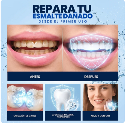 Dental Cavity Healing - La fórmula con nano-hidroxiapatita que  devuelve la fuerza natural a tus dientes